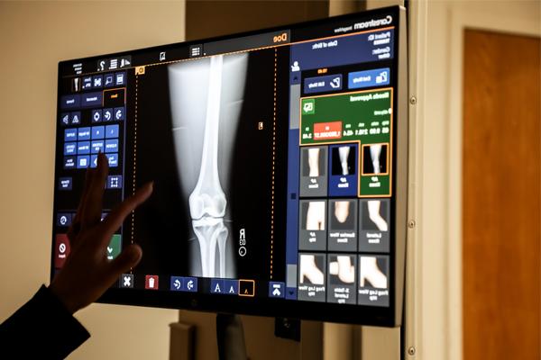 Hand pointing at an x-ray on a computer monitor